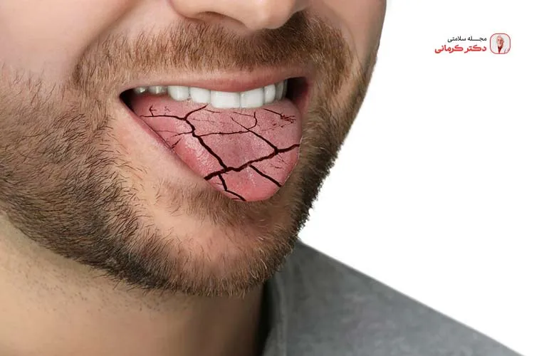 علت تلخی دهان