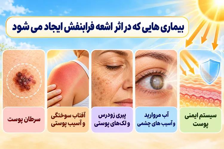 اشعه ماورا بنفش باعث چه بیماری هایی می‌شود؟