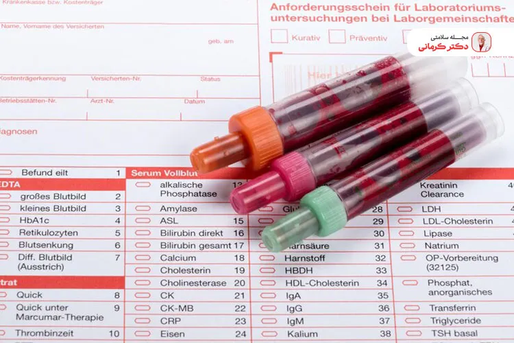 تفسیر آزمایش قند خون حتما باید توسط پزشک انجام شود.