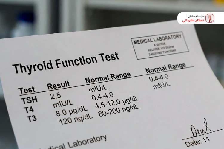 عکس ازمایش تیروئید نرمال 