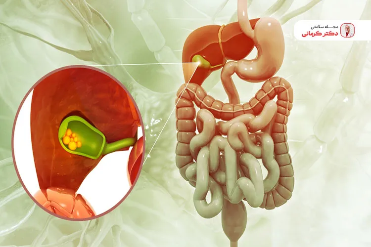 کیسه صفرا با ذخیره و آزاد کردن صفرا به هضم چربی کمک می‌کند و تاثیر مستقیمی بر جذب چربی و وزن بدن دارد.