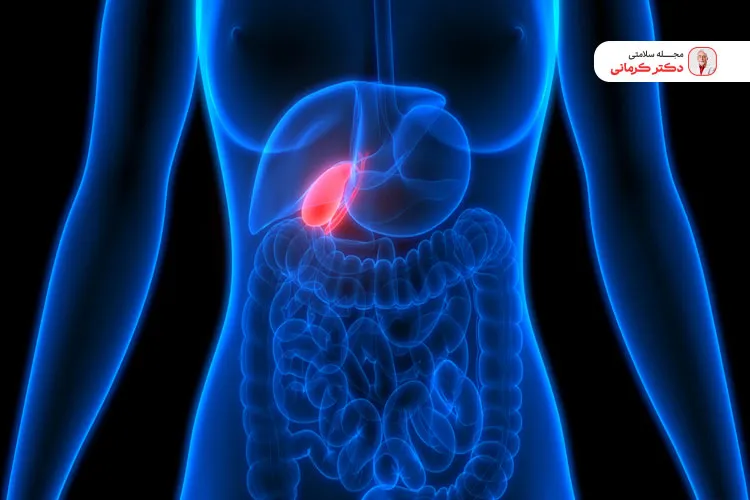 عدم رعایت برنامه غذایی موجب چاقی بعد از عمل کیسه صفرا می‌شود.