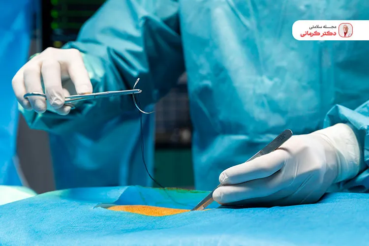 لاغری با امبدینگ نمی‌تواند جایگزین قطعی تغذیه اصولی و ورزش باشد.